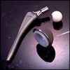Components of a modern total hip replacement